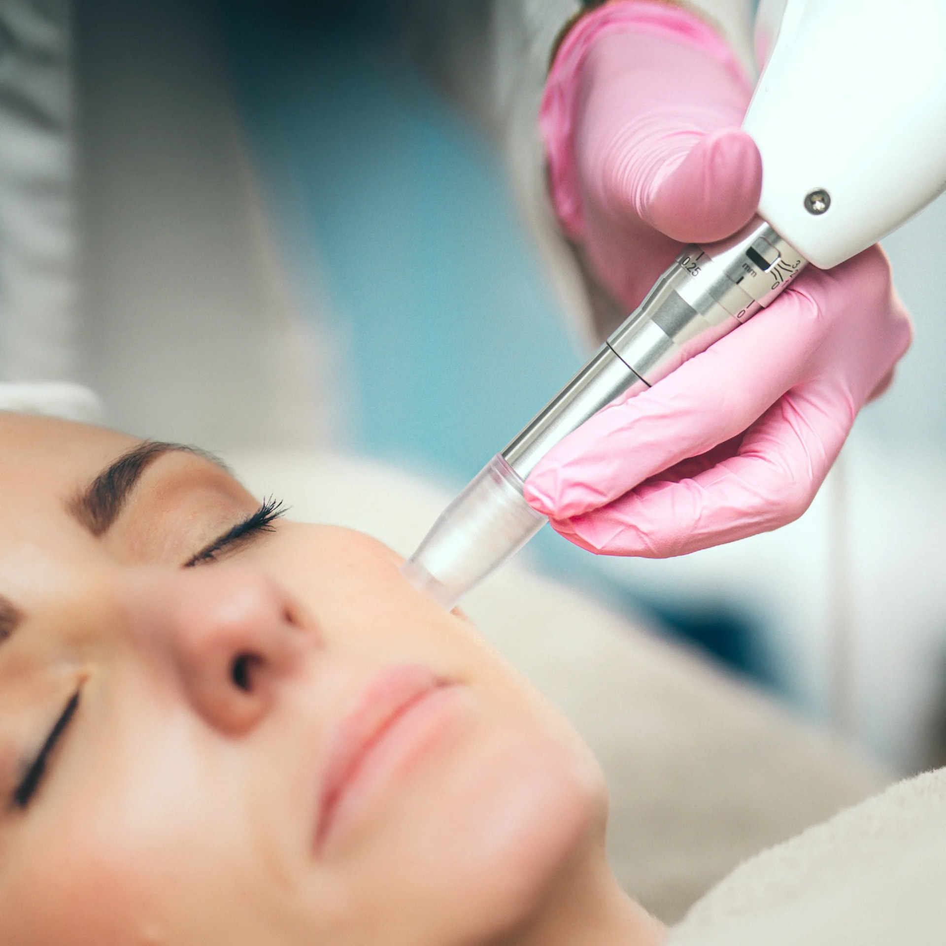 Xcellaris Pro Twist-microneedling av ansiktet