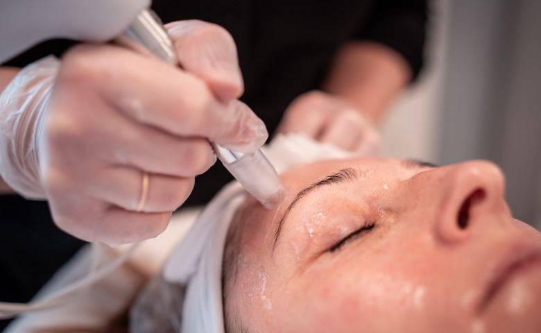 Nærbilde av Xcellaris Pro Twist-behandling i klinikk